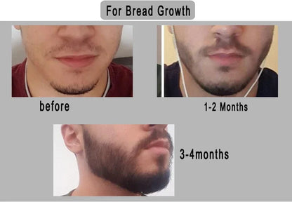 540 Titanium Derma Roller – Hair Growth & Skin Rejuvenation Tool | Microneedling Therapy