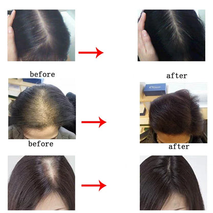 540 Titanium Derma Roller – Hair Growth & Skin Rejuvenation Tool | Microneedling Therapy