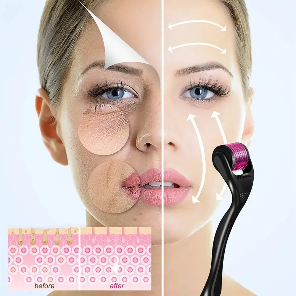 540 Titanium Derma Roller – Hair Growth & Skin Rejuvenation Tool | Microneedling Therapy